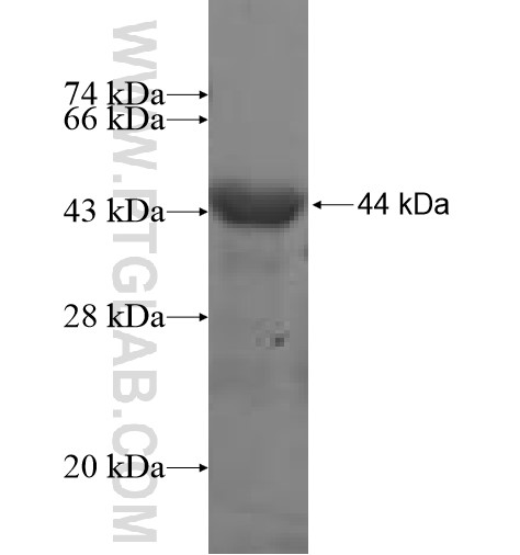 PEX6 fusion protein Ag11245 SDS-PAGE PEX6 fusion protein Ag11245 SDS-PAGE