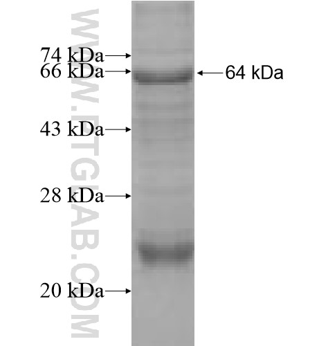 PEX6 fusion protein Ag11246 SDS-PAGE PEX6 fusion protein Ag11246 SDS-PAGE