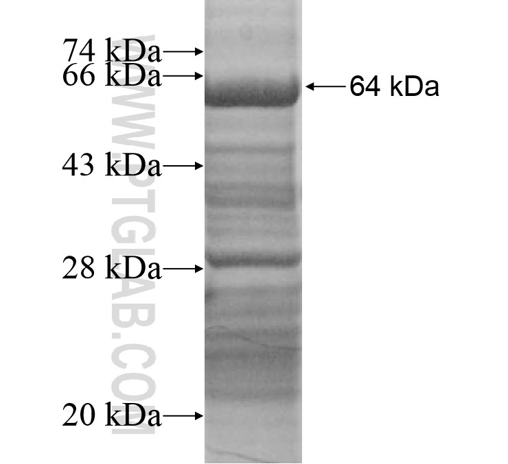 PEX6 fusion protein Ag15201 SDS-PAGE