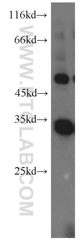 WB analysis of MDA-MB-453s using 20614-1-AP