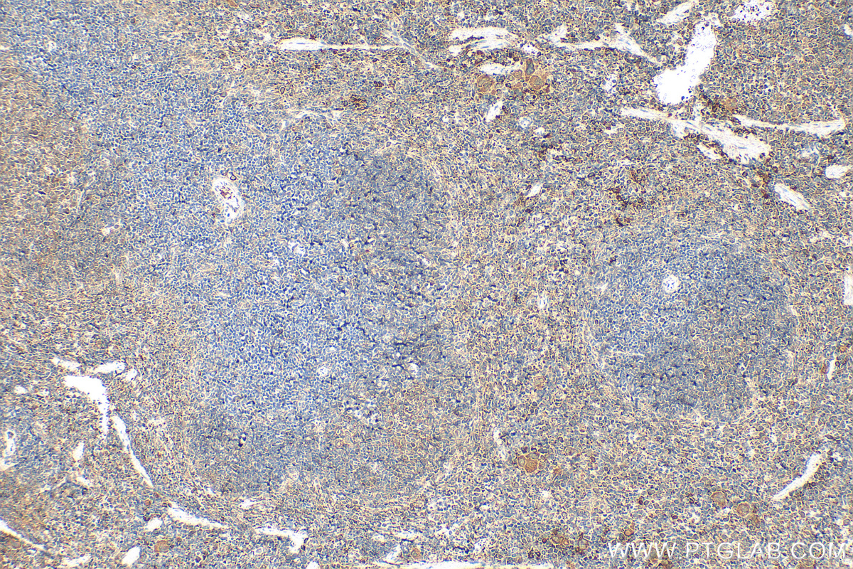 IHC staining of mouse spleen using 21157-1-AP