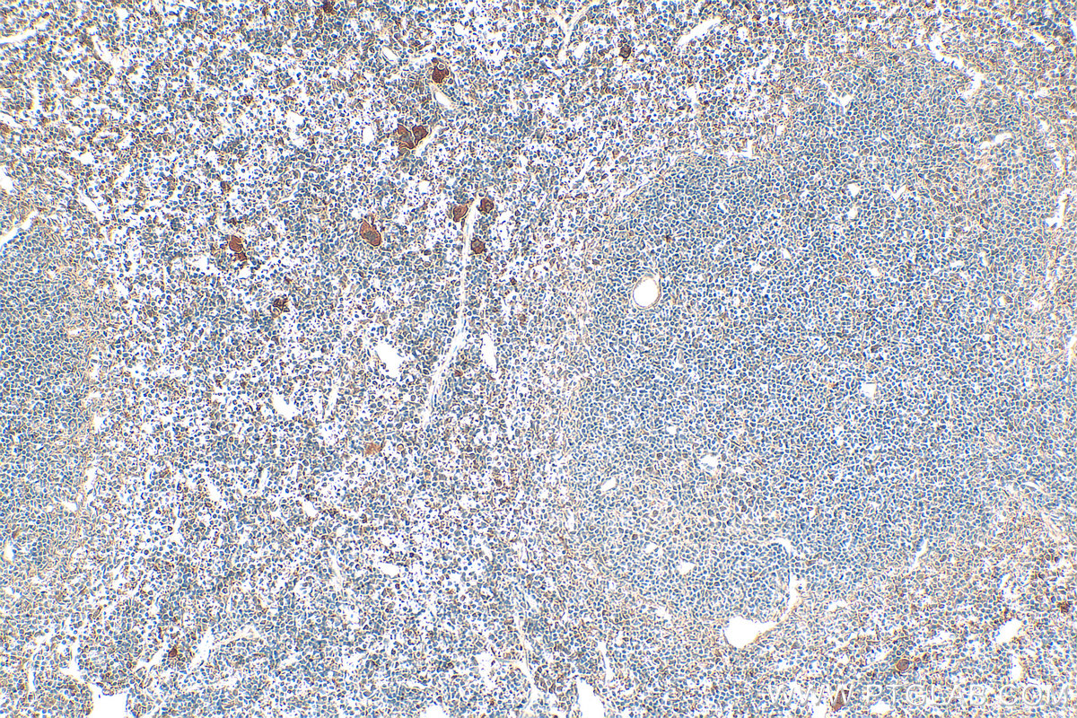 IHC staining of mouse spleen using 21157-1-AP