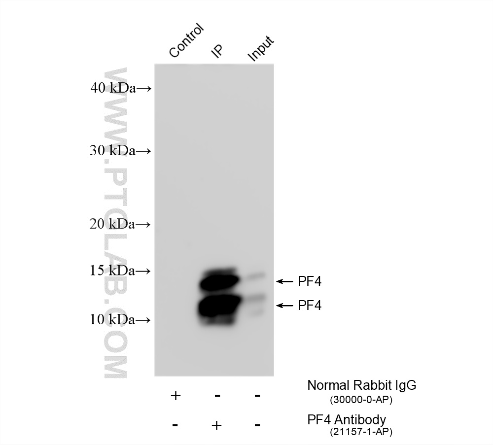IP experiment of mouse serum using 21157-1-AP