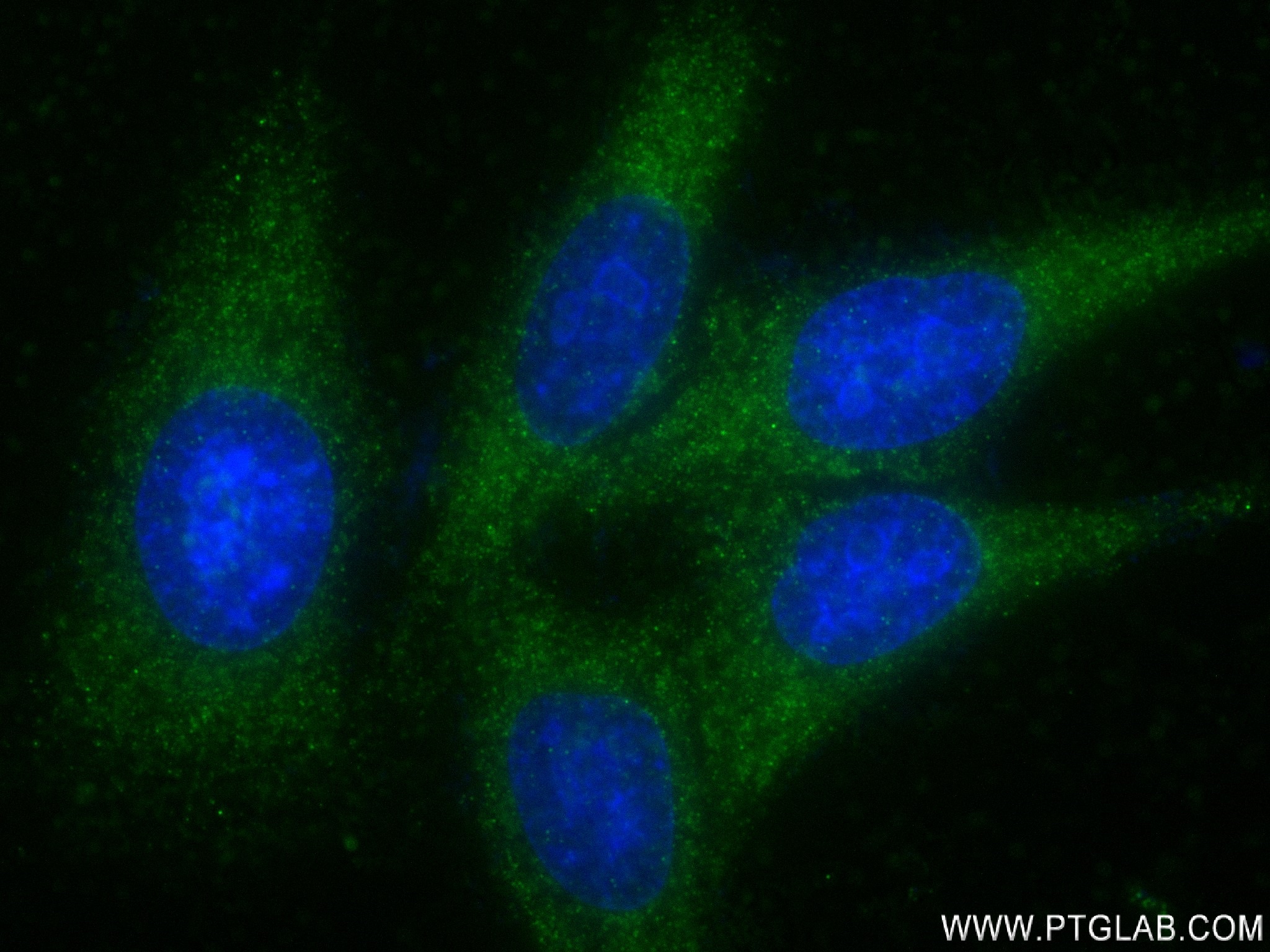 IF Staining of HepG2 using 83074-3-RR