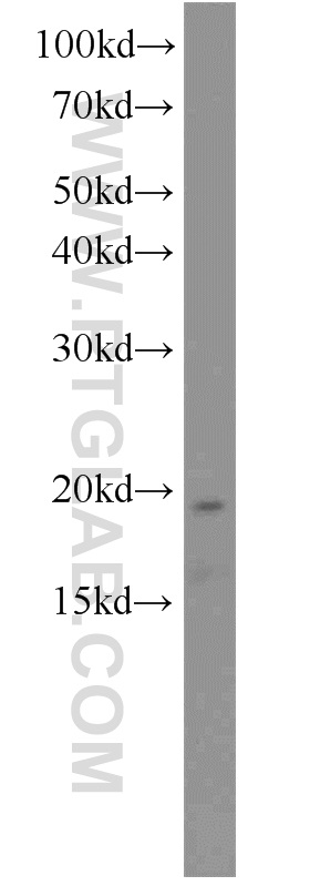 WB analysis of L02 using 13053-1-AP