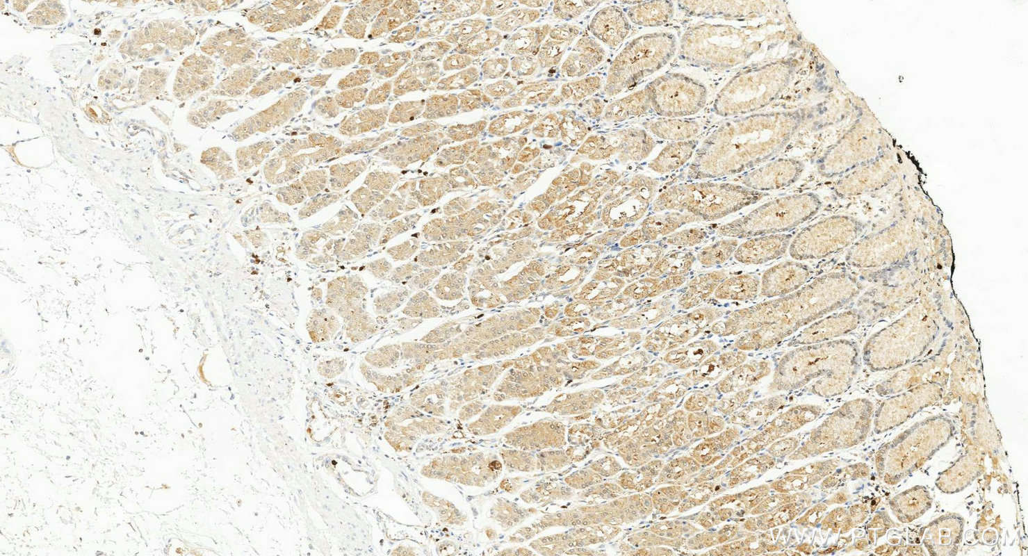 IHC staining of human stomach using 15078-1-AP (same clone as 15078-1-PBS)