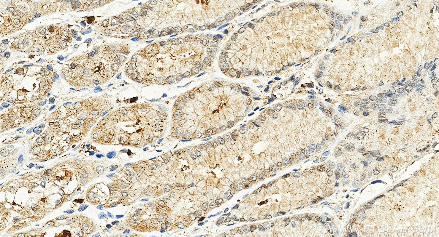 IHC staining of human stomach using 15078-1-AP (same clone as 15078-1-PBS)