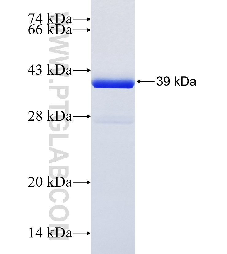 PFDN6 fusion protein Ag4488 SDS-PAGE