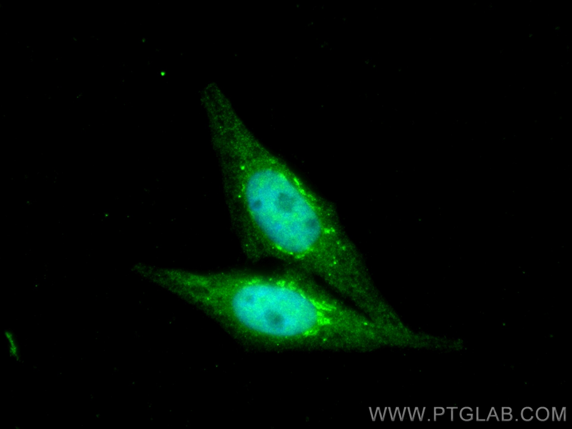 IF Staining of HepG2 using 13763-1-AP