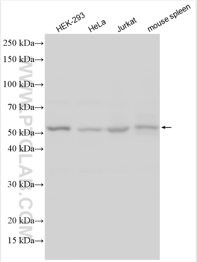 WB analysis using 13763-1-AP