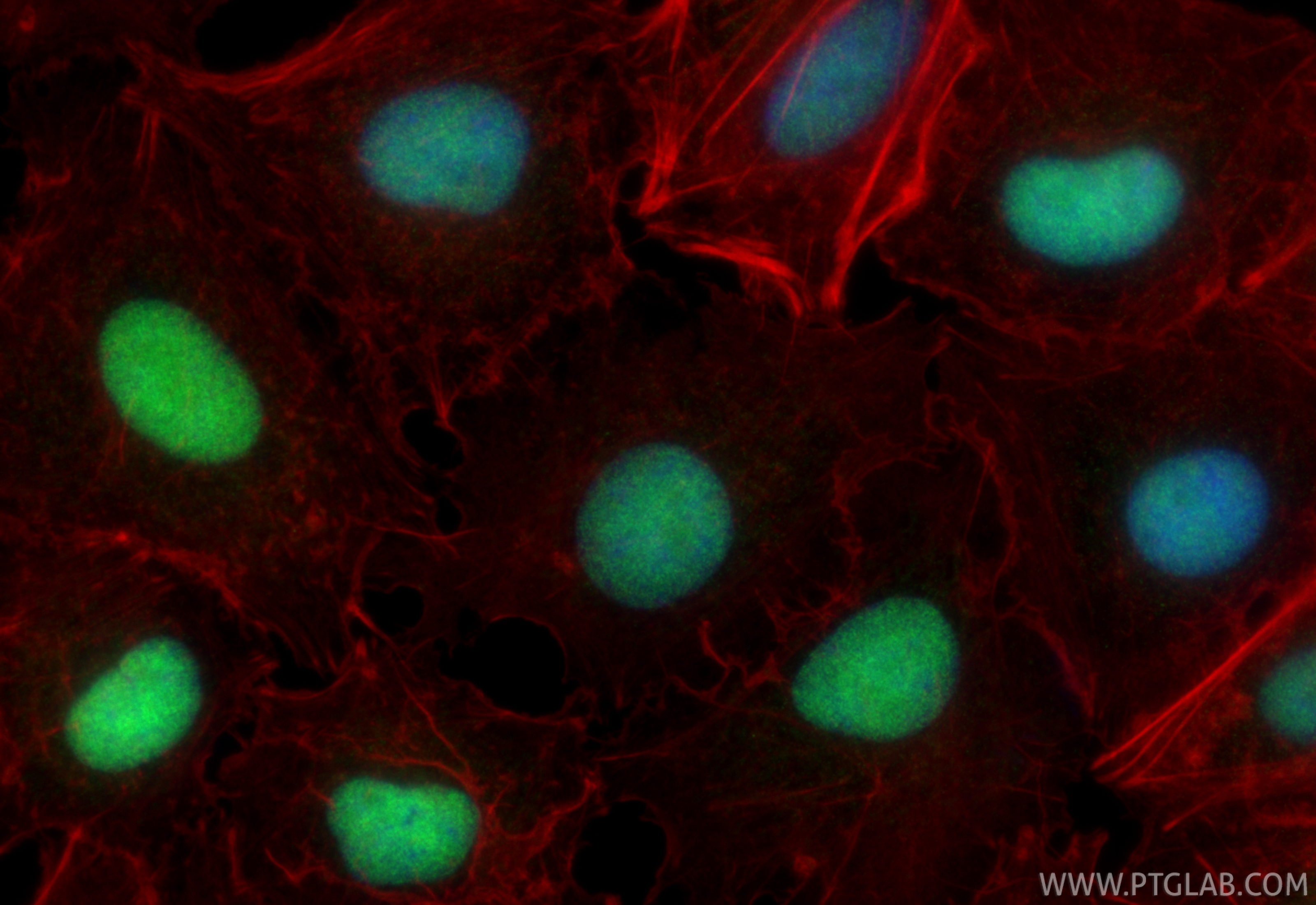 IF Staining of A549 using 87233-1-RR IF Staining of A549 using 87233-1-RR