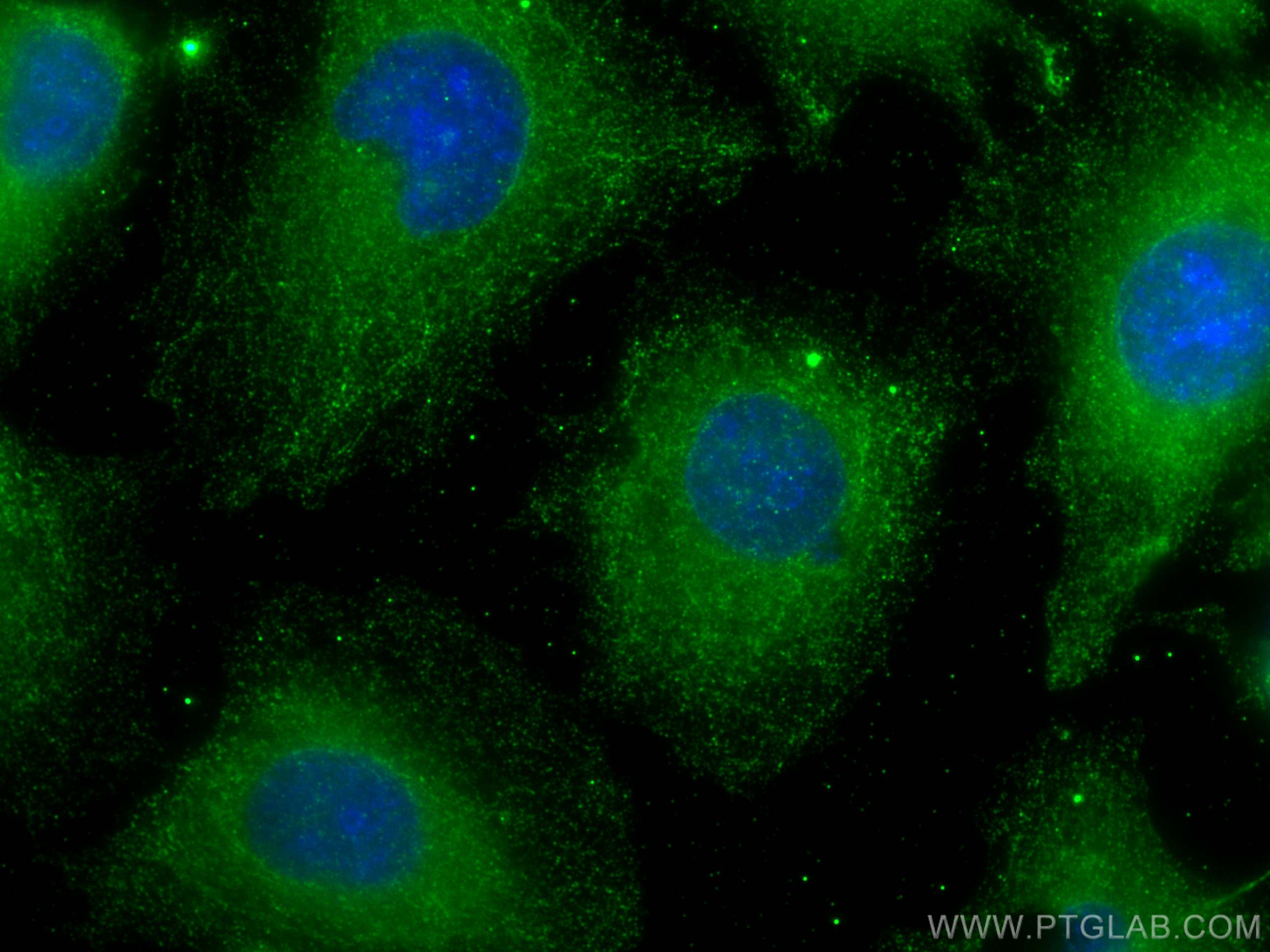 IF Staining of HUVEC using 29902-1-AP