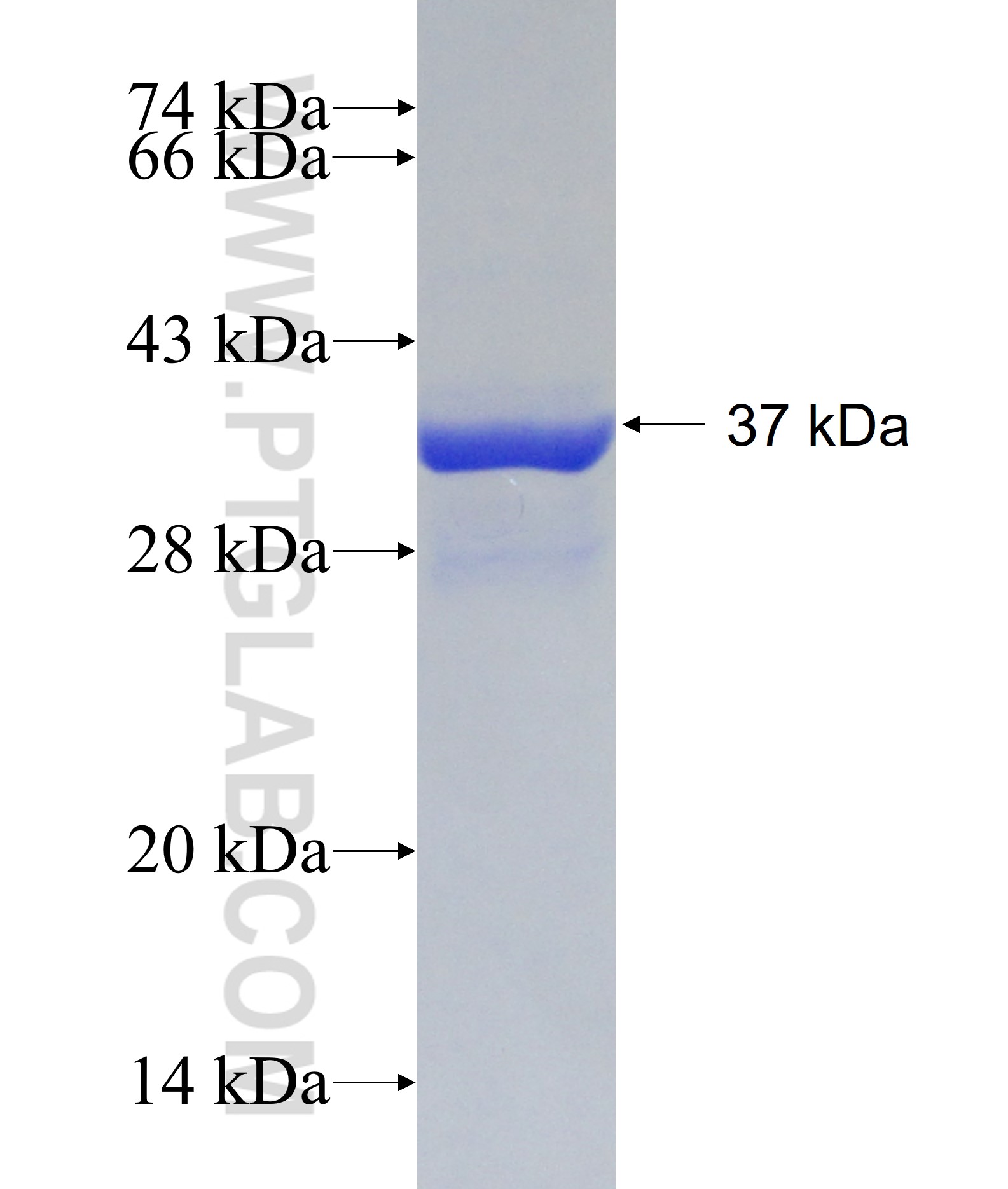 PFKFB4 fusion protein Ag30571 SDS-PAGE