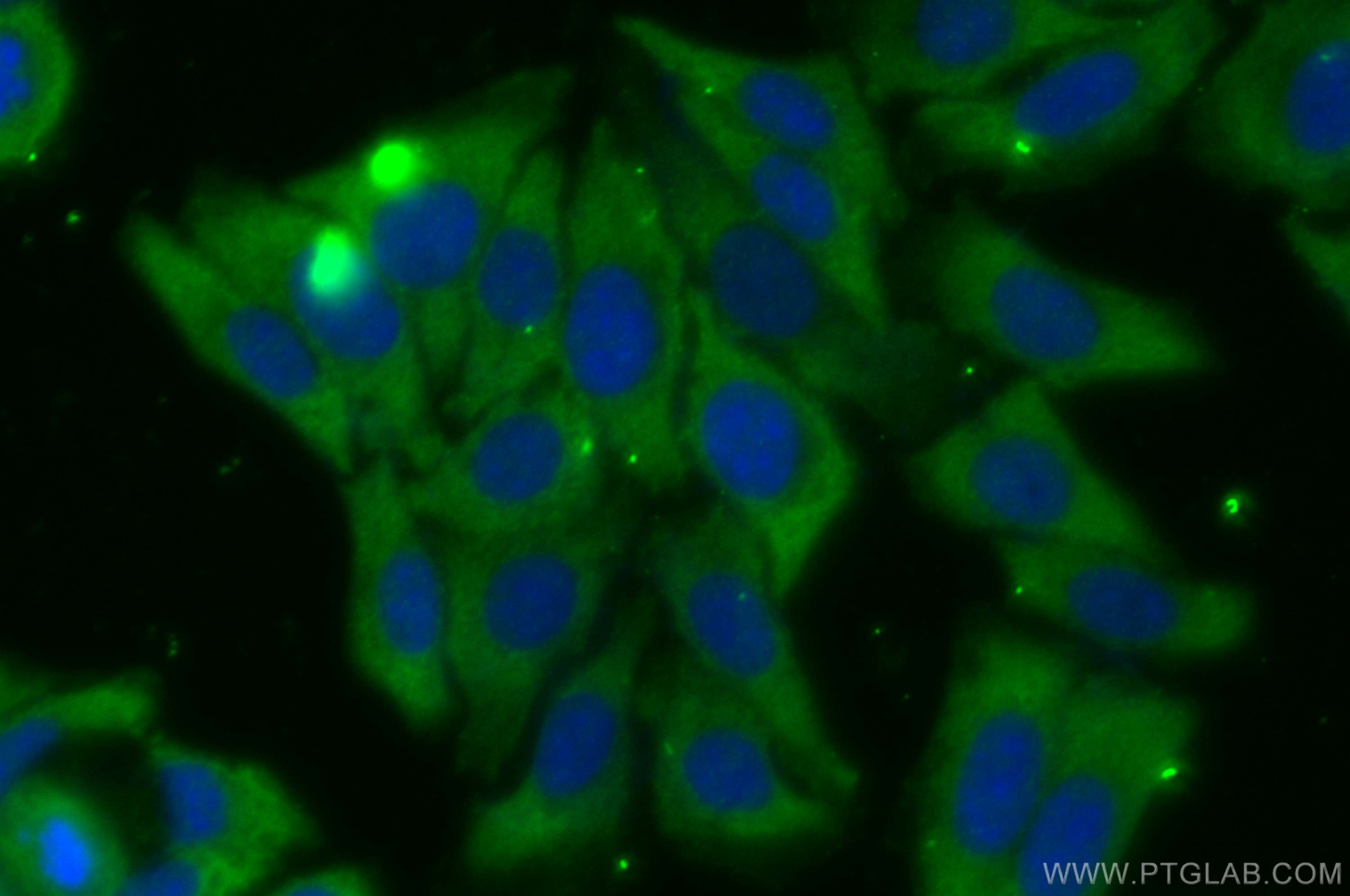 IF Staining of HepG2 using 30326-1-AP