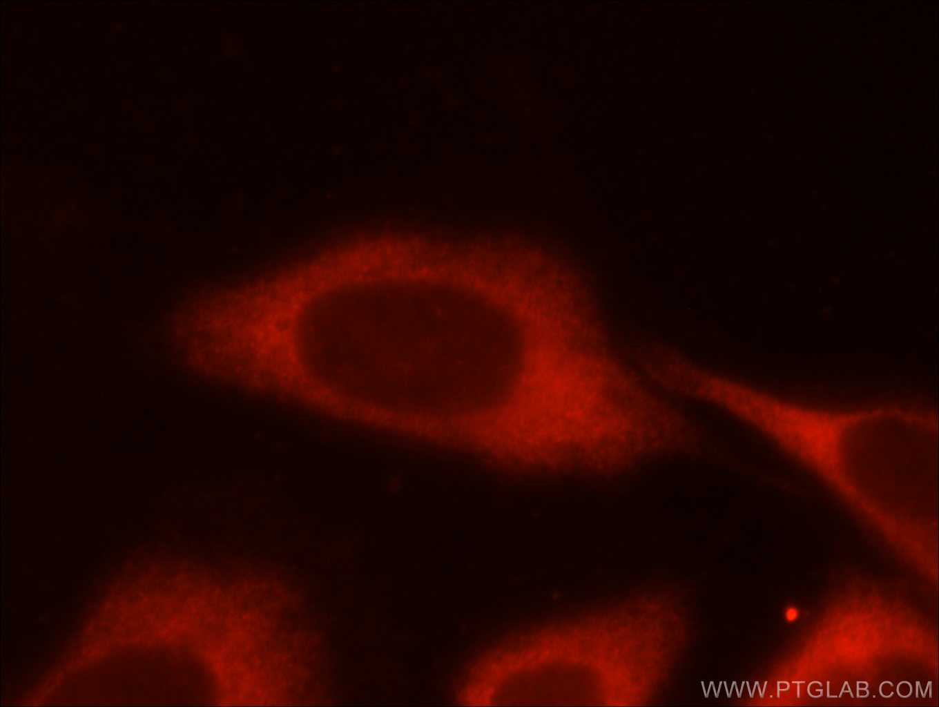 IF Staining of HeLa using 55028-1-AP