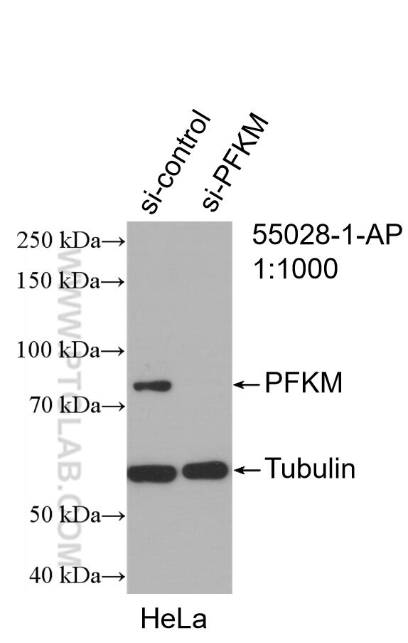 WB analysis of HeLa using 55028-1-AP