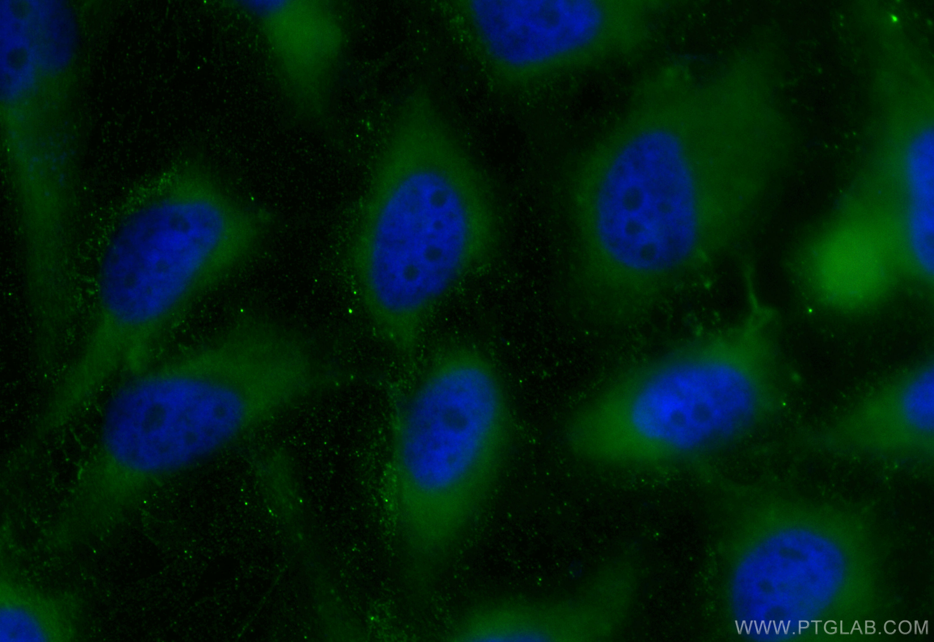 IF Staining of HeLa using CL488-84281-5