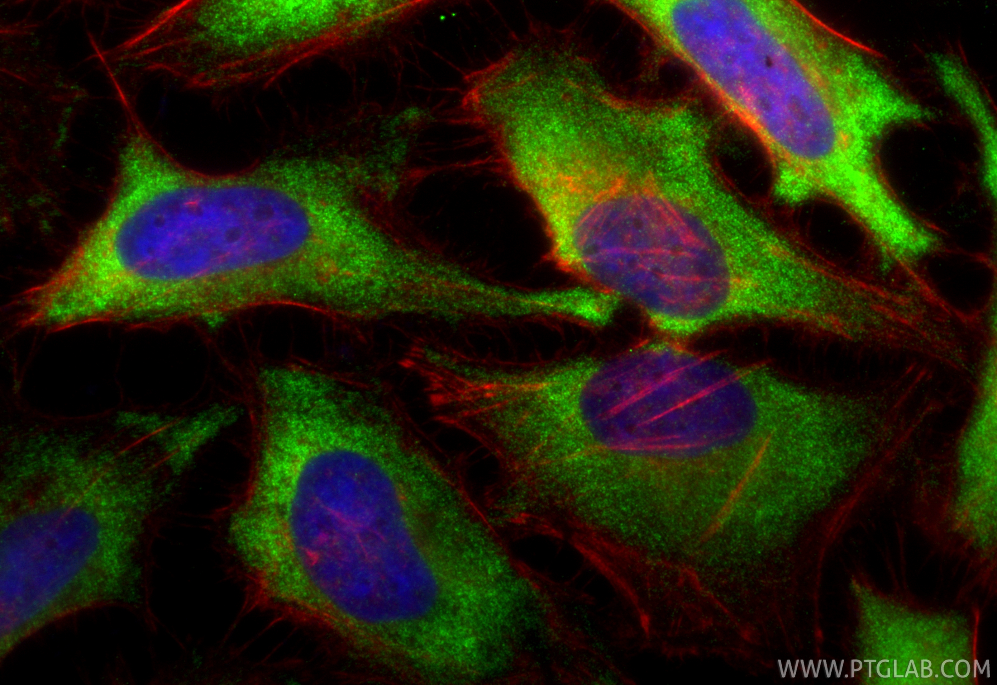 IF Staining of HeLa using RMX00037 IF Staining of HeLa using RMX00037