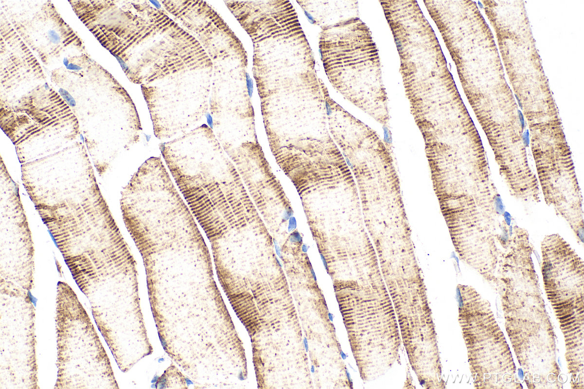 IHC staining of mouse skeletal muscle using RMX00037 IHC staining of mouse skeletal muscle using RMX00037