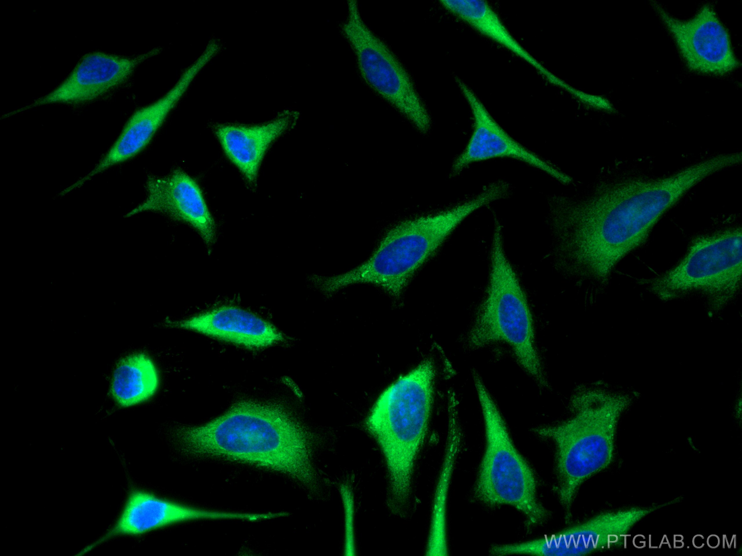 IF Staining of HeLa using 13389-1-AP