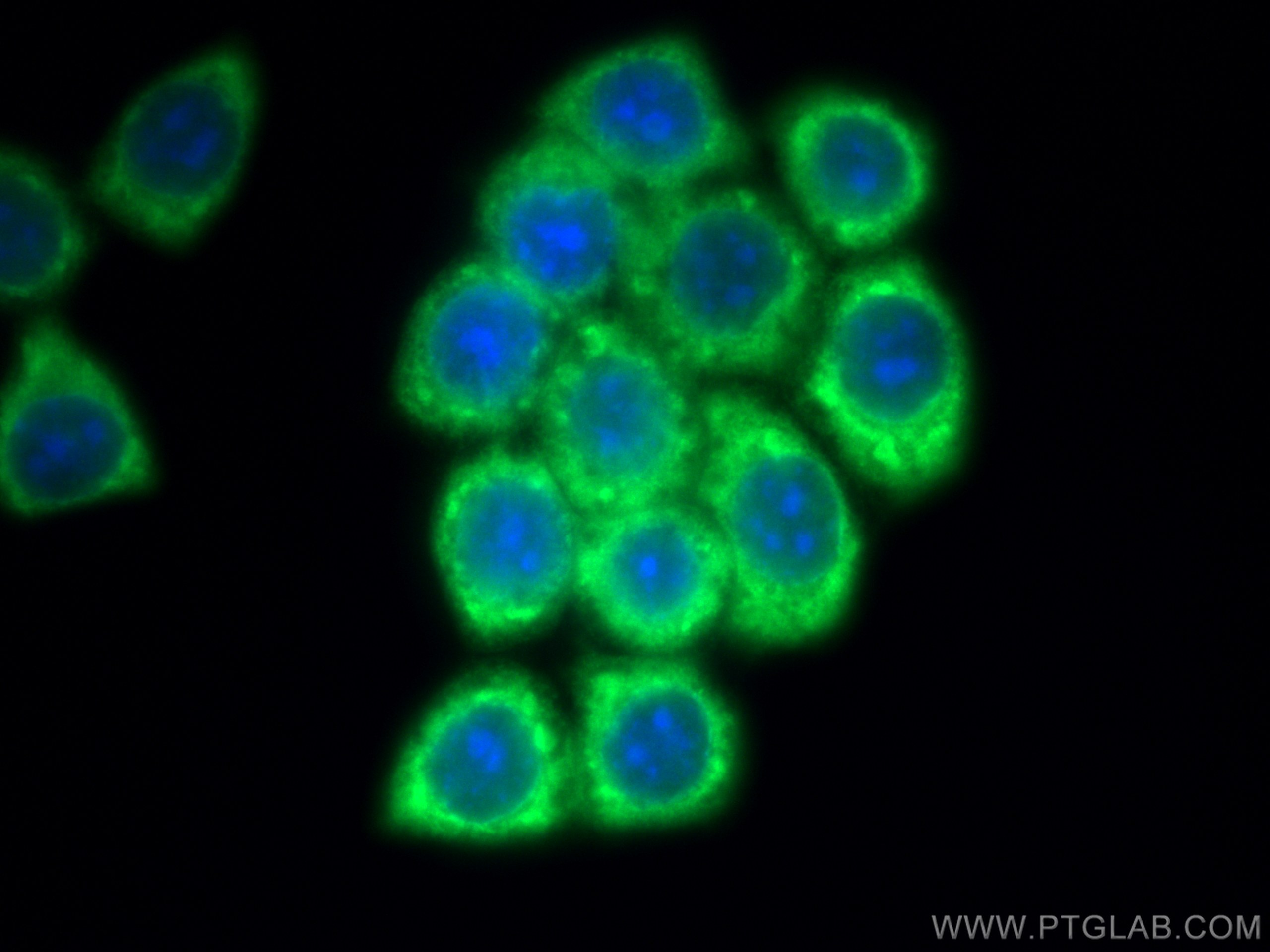 IF Staining of BxPC-3 using 13389-1-AP