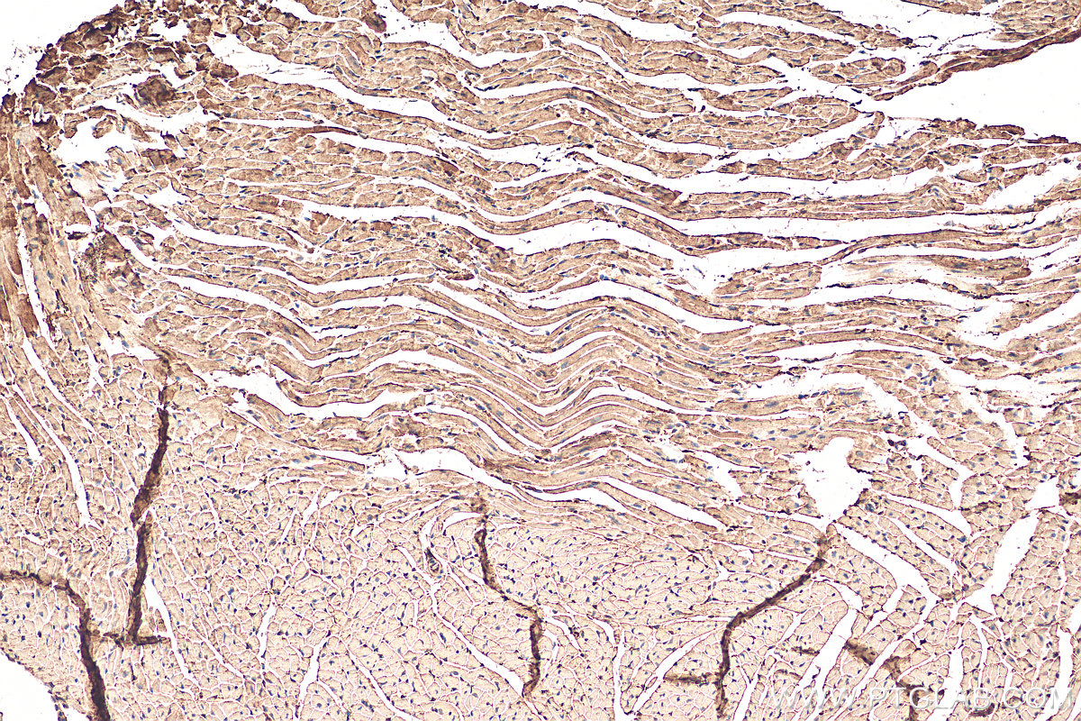 IHC staining of mouse heart using 13389-1-AP