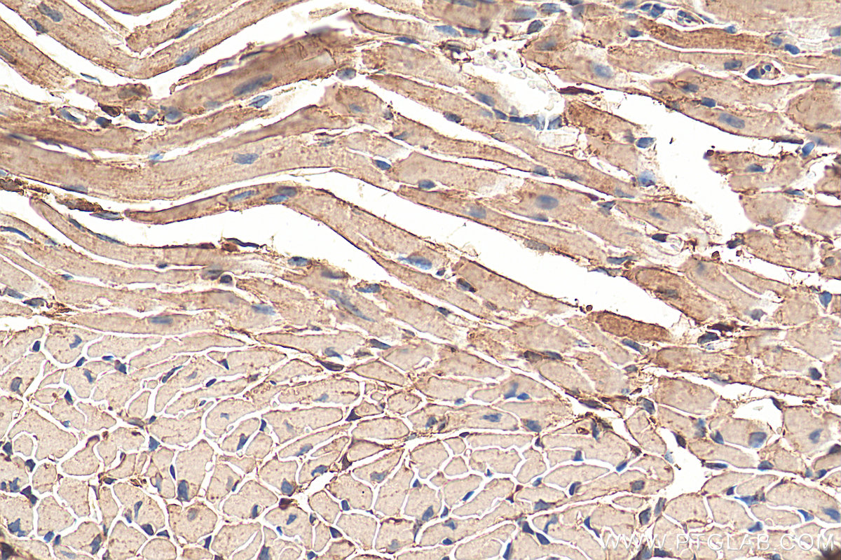 IHC staining of mouse heart using 13389-1-AP