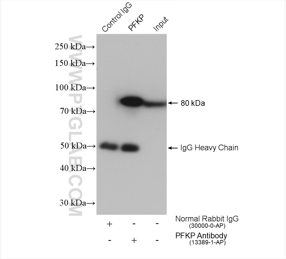 IP experiment of Jurkat using 13389-1-AP