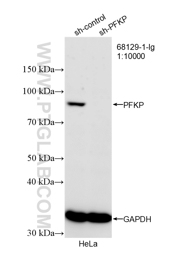 WB analysis of HeLa using 68129-1-Ig (same clone as 68129-1-PBS)