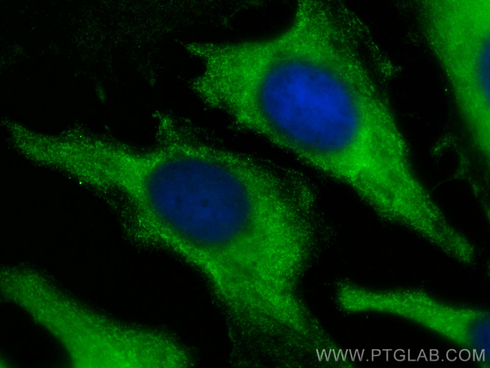 IF Staining of HeLa using CL488-68129