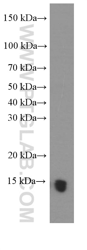 WB analysis of mouse brain using 60094-2-Ig