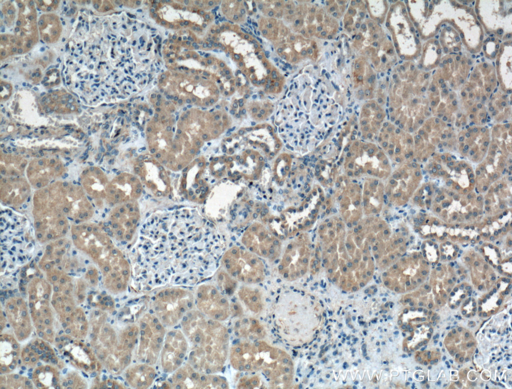 PFTK1 Polyclonal antibody