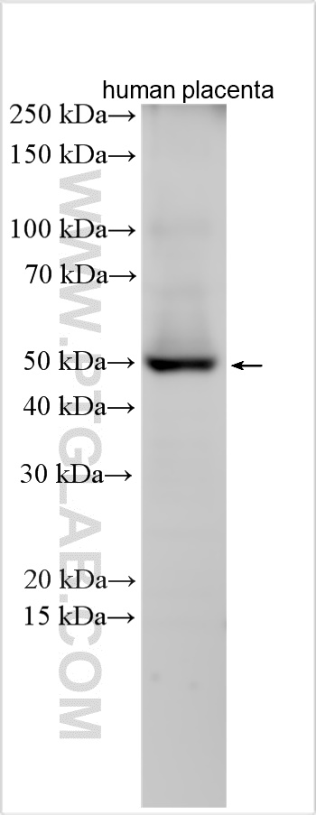 WB analysis using 17423-1-AP