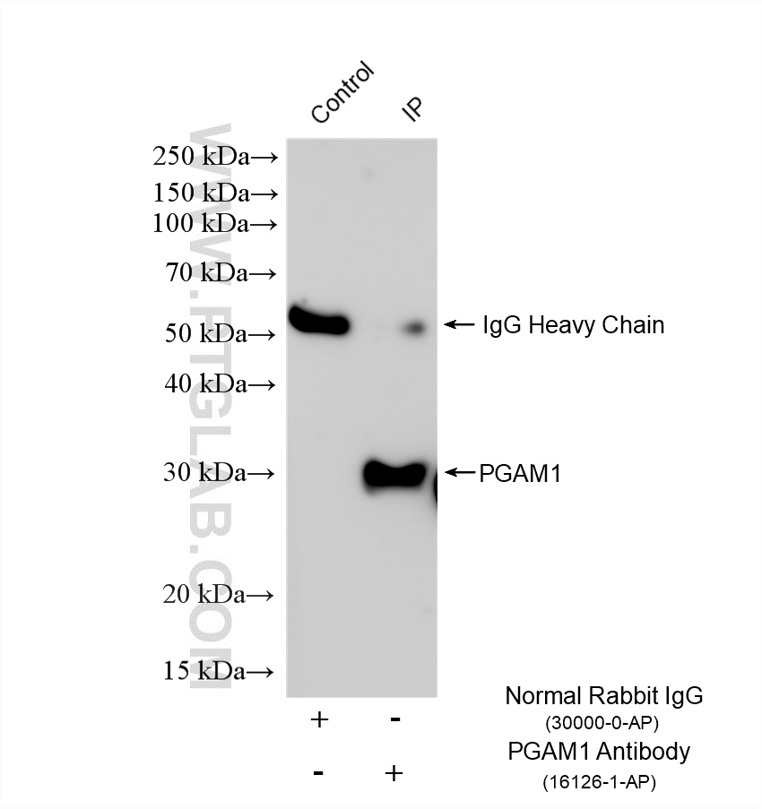 IP experiment of HeLa using 16126-1-AP