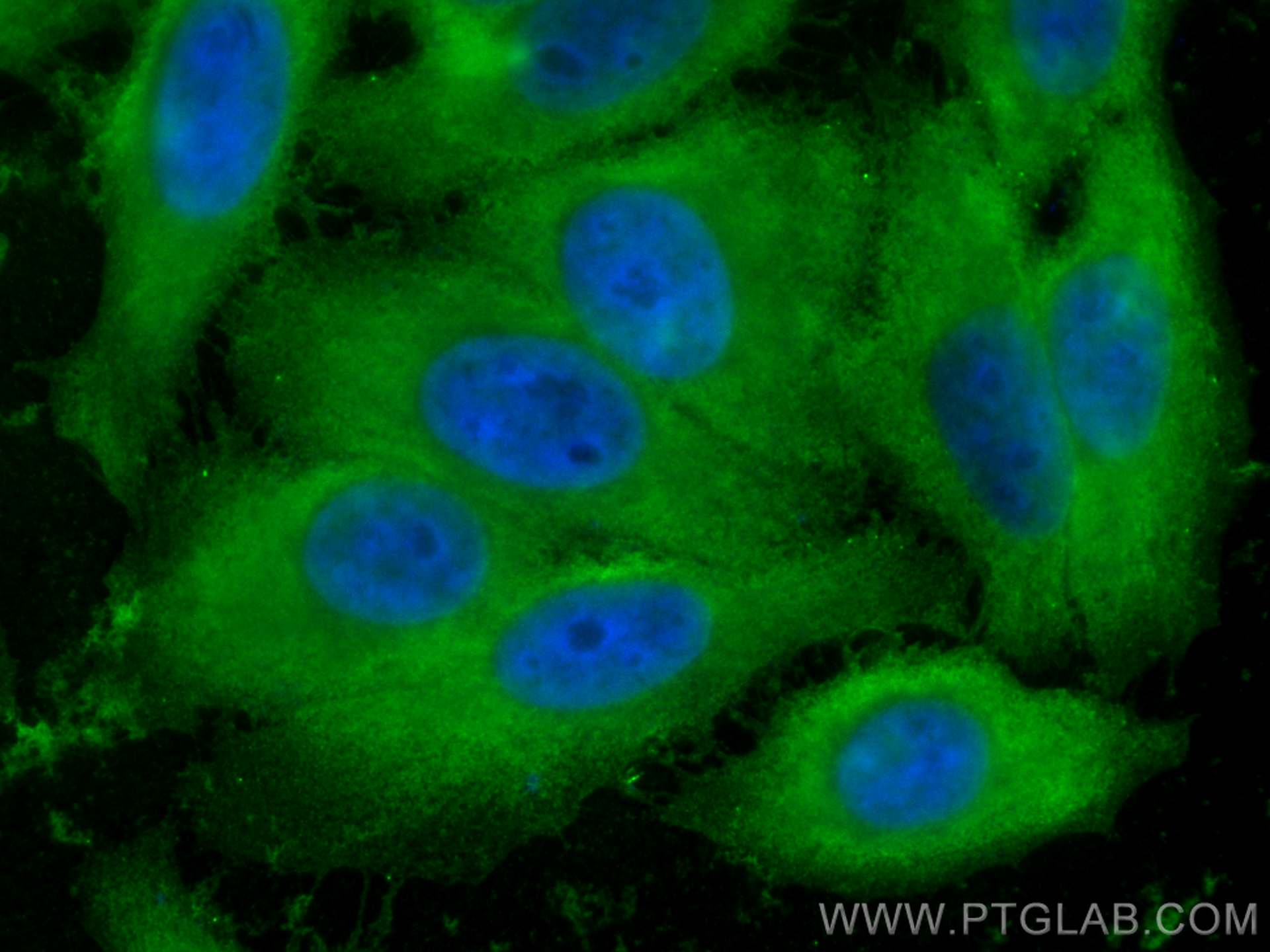 IF Staining of HepG2 using 67470-1-Ig (same clone as 67470-1-PBS)