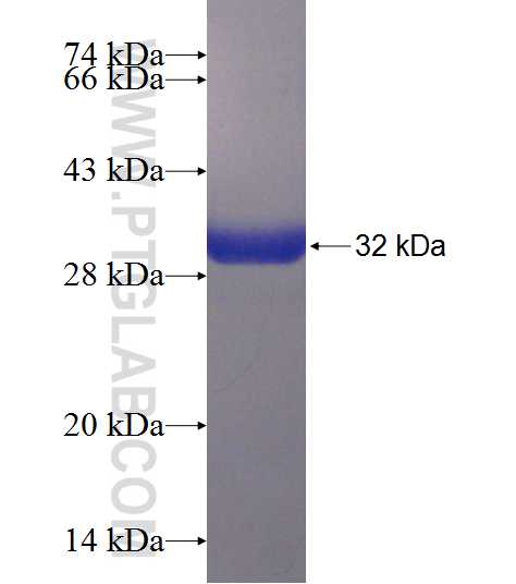 PGAM2 fusion protein Ag8126 SDS-PAGE PGAM2 fusion protein Ag8126 SDS-PAGE