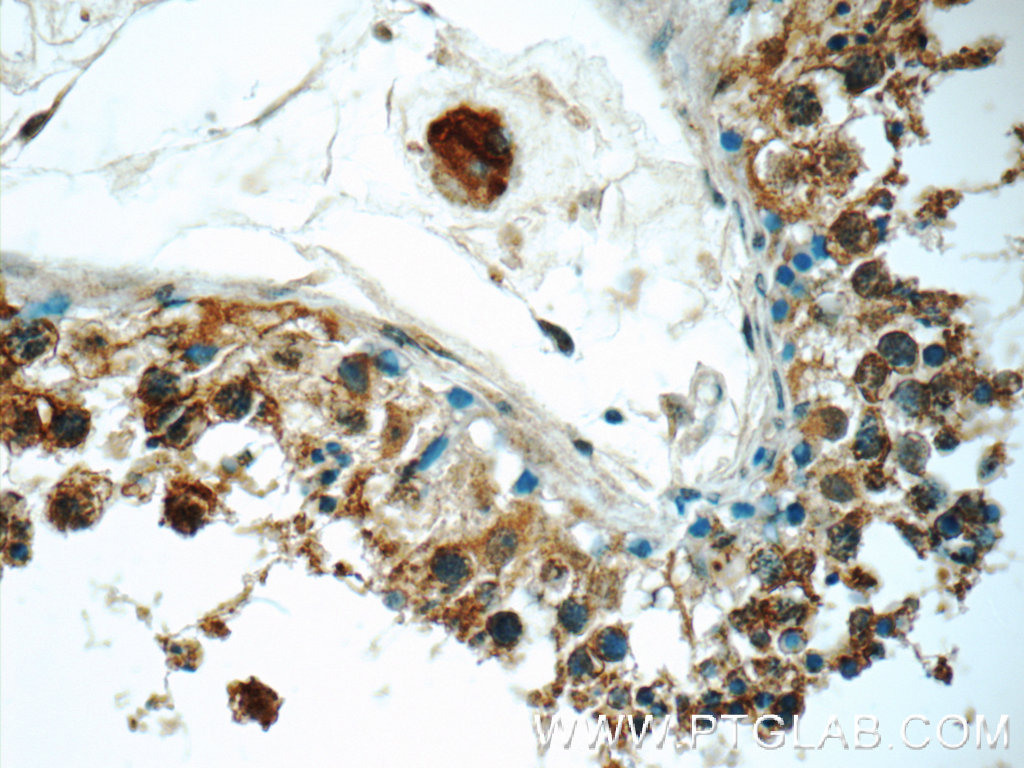 IHC staining of human testis using 25539-1-AP