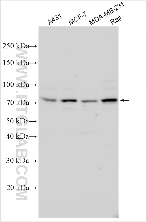 WB analysis using 32839-1-AP (same clone as 32839-1-PBS)