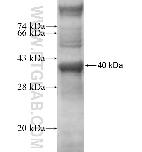 PGBD3 fusion protein Ag11857 SDS-PAGE PGBD3 fusion protein Ag11857 SDS-PAGE