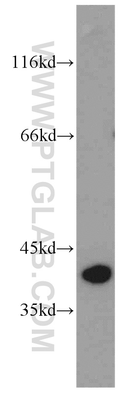 WB analysis of human stomach using 16881-1-AP