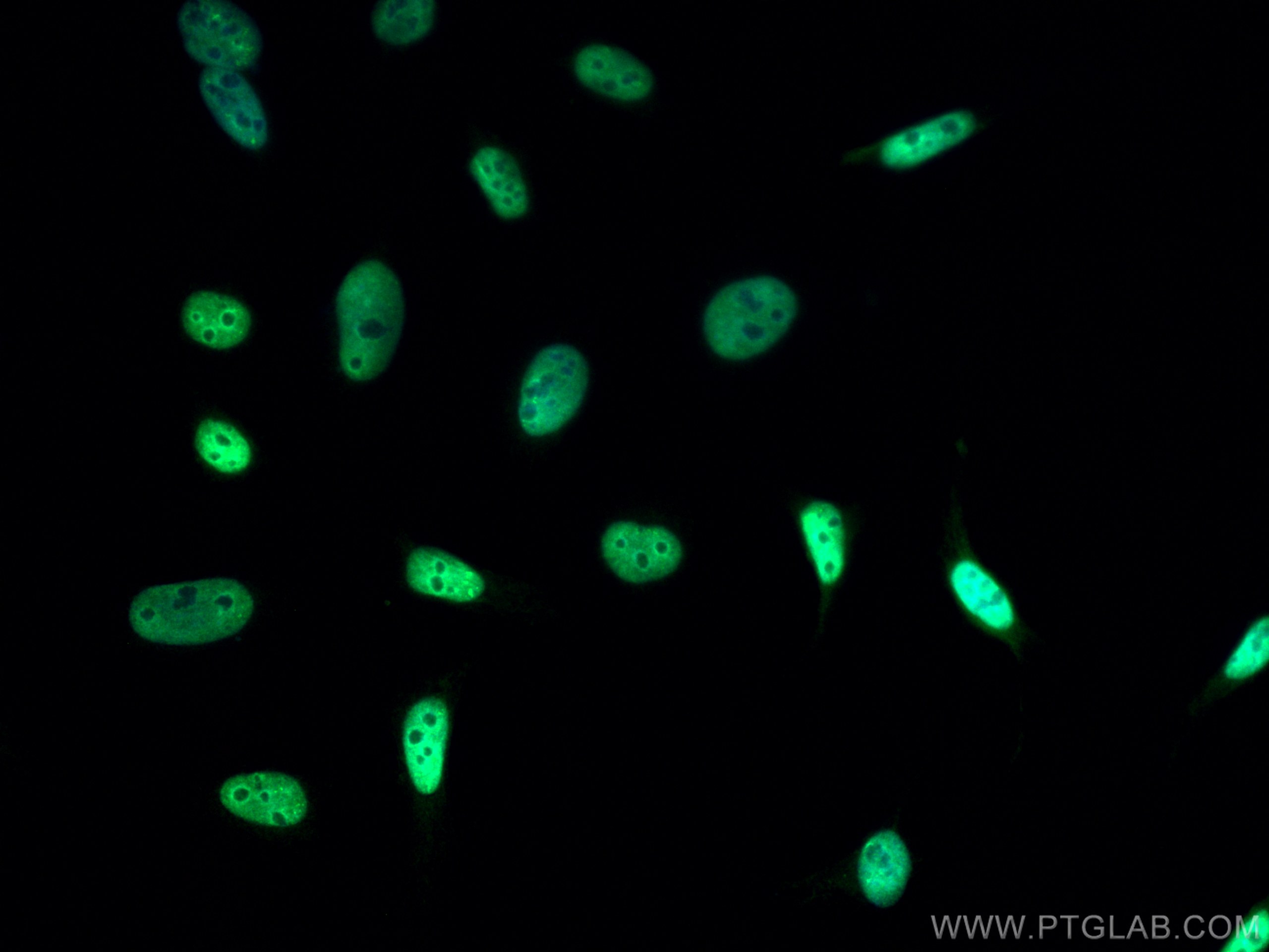 IF Staining of HeLa using CL488-66369