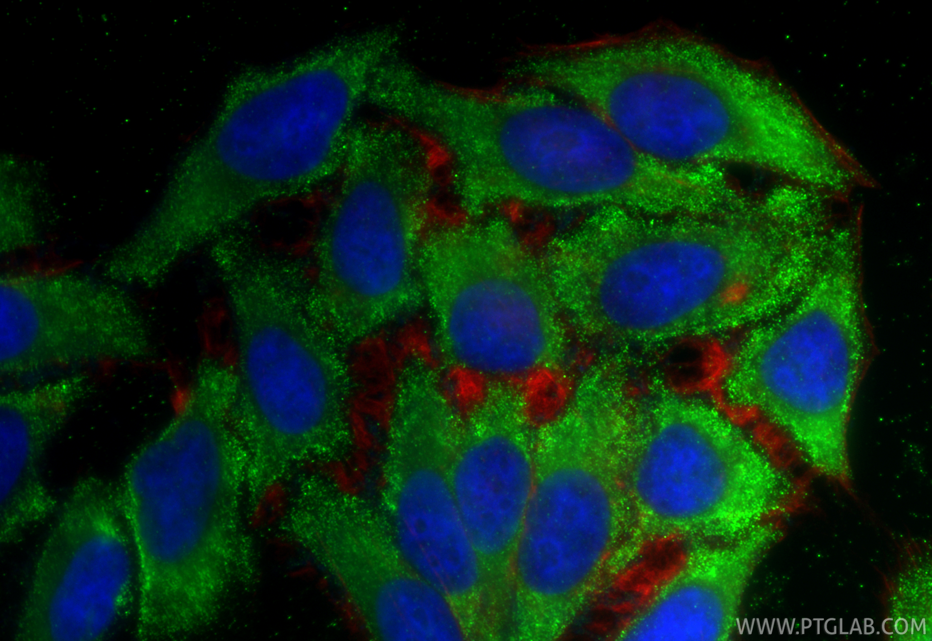 IF Staining of HepG2 using 67916-1-Ig IF Staining of HepG2 using 67916-1-Ig