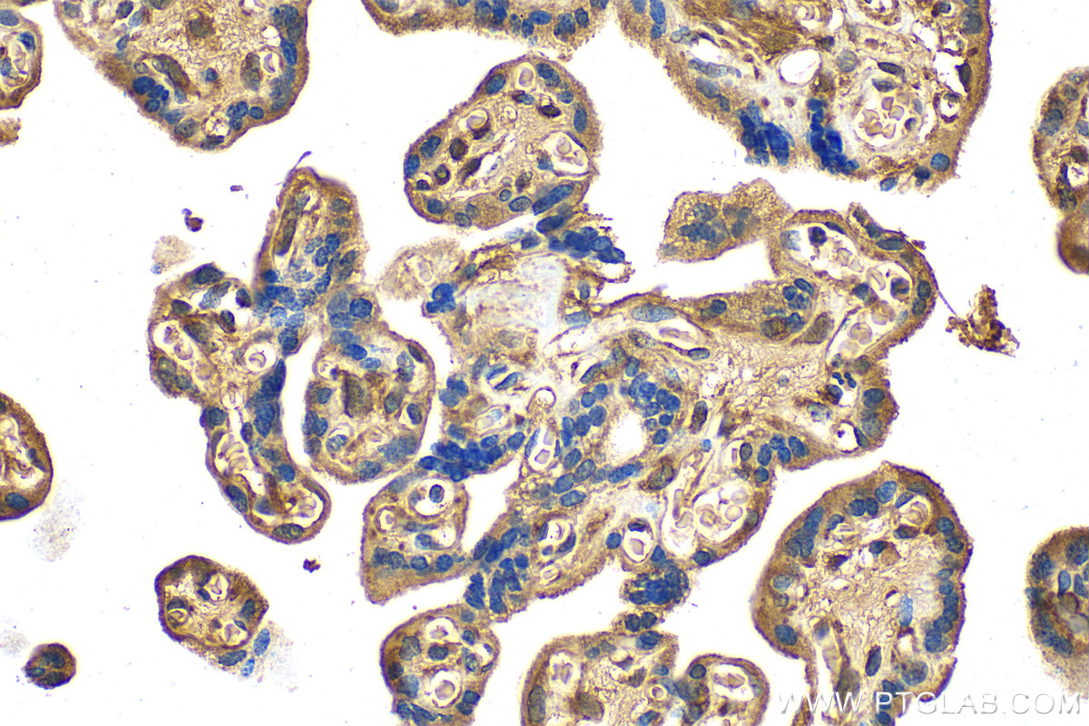 IHC staining of human placenta using 22522-1-AP