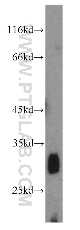 WB analysis of mouse small intestine using 22522-1-AP