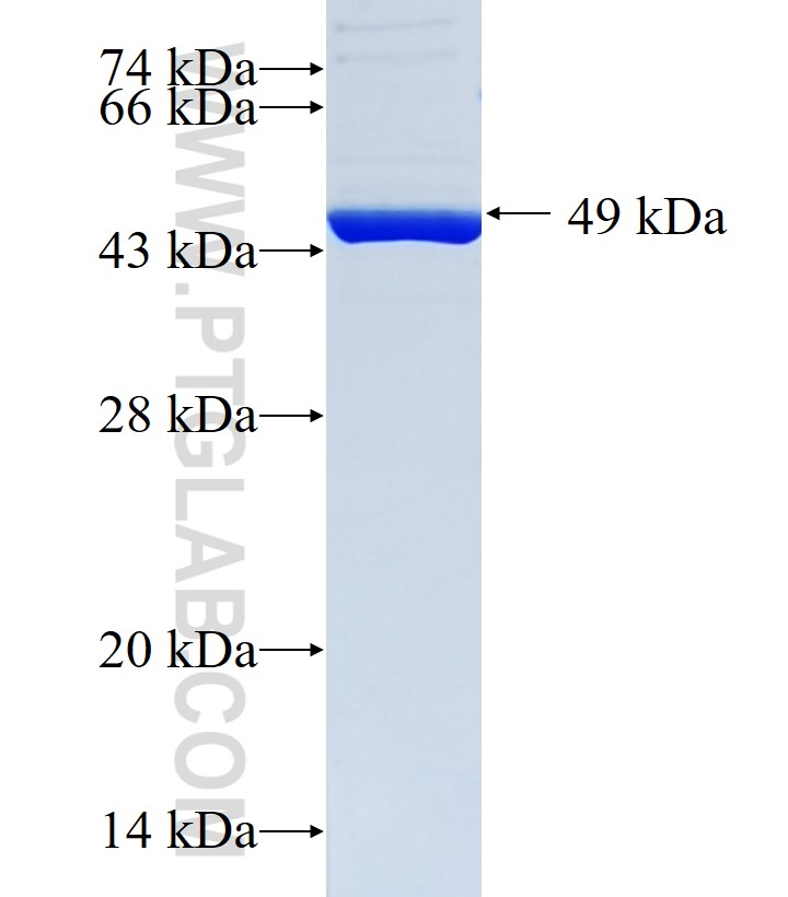 PGDS fusion protein Ag18290 SDS-PAGE