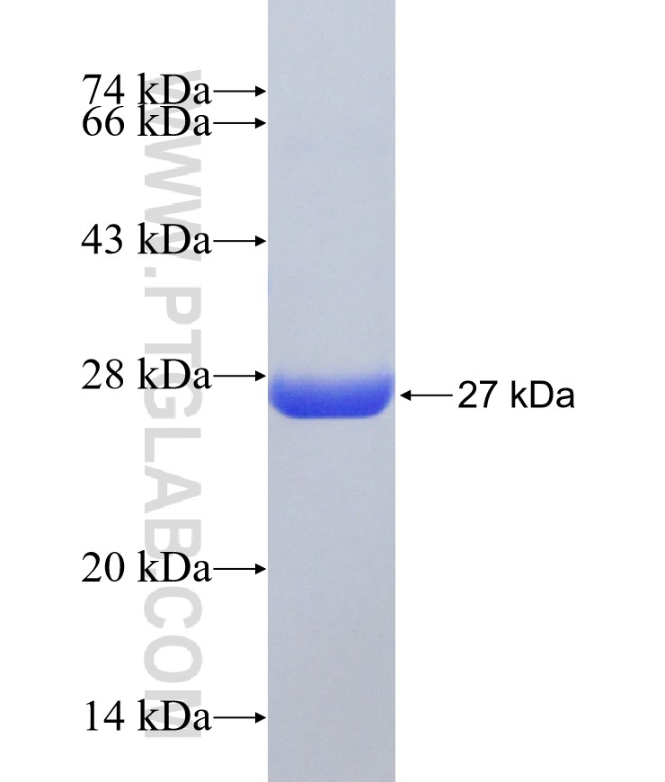 PGDS fusion protein Ag18339 SDS-PAGE PGDS fusion protein Ag18339 SDS-PAGE