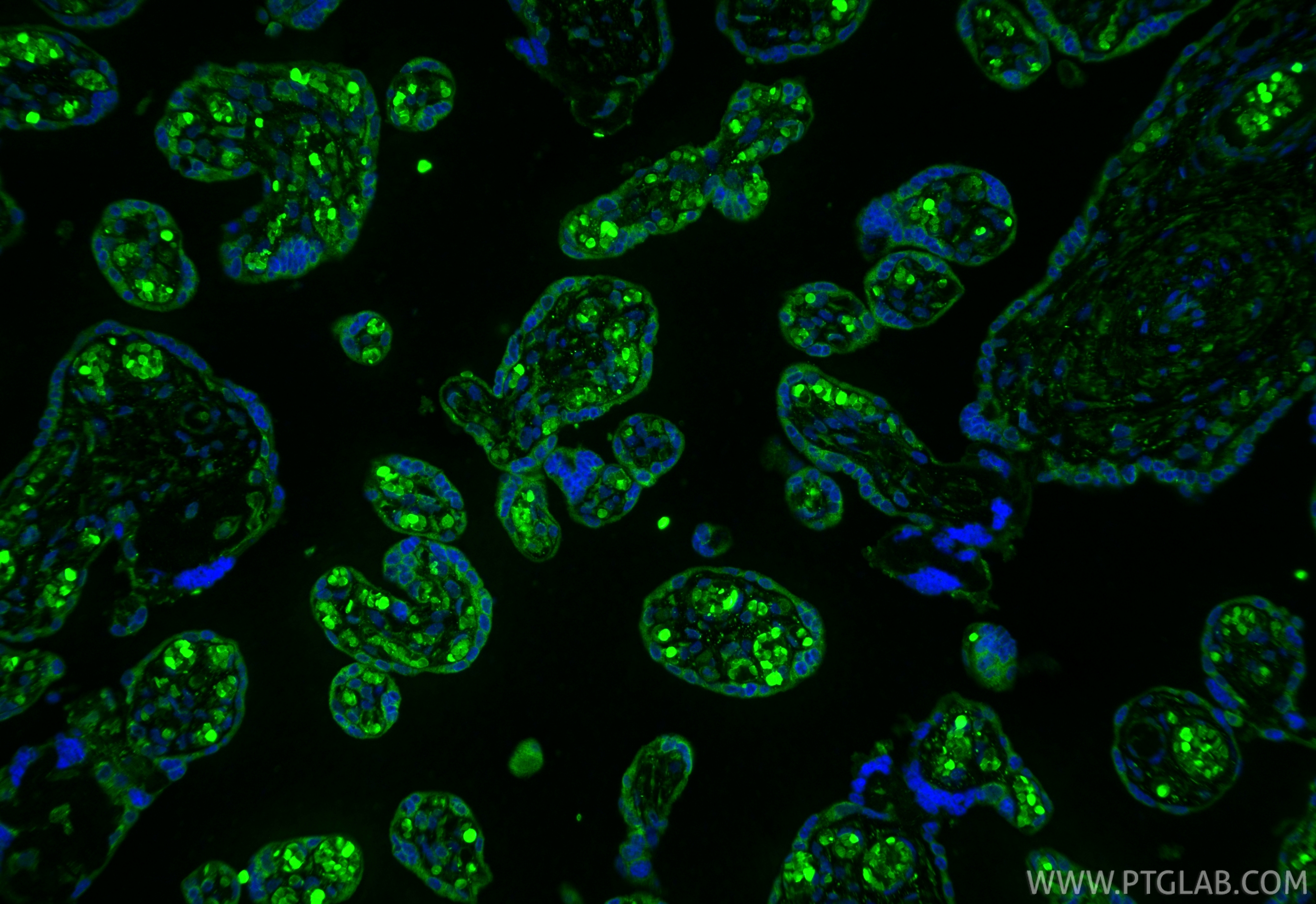 IF Staining of human placenta using 10642-1-AP IF Staining of human placenta using 10642-1-AP