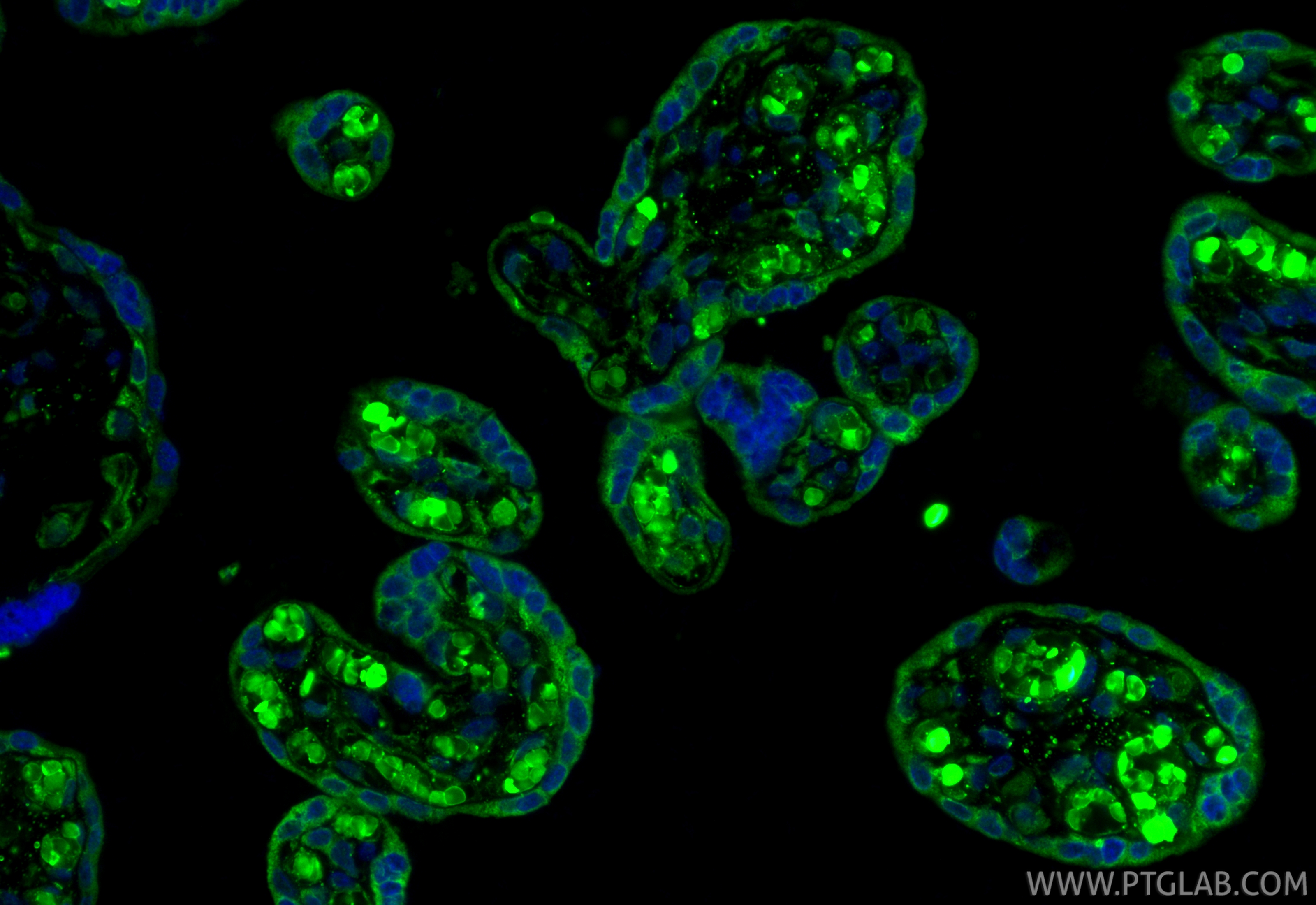 IF Staining of human placenta using 10642-1-AP IF Staining of human placenta using 10642-1-AP