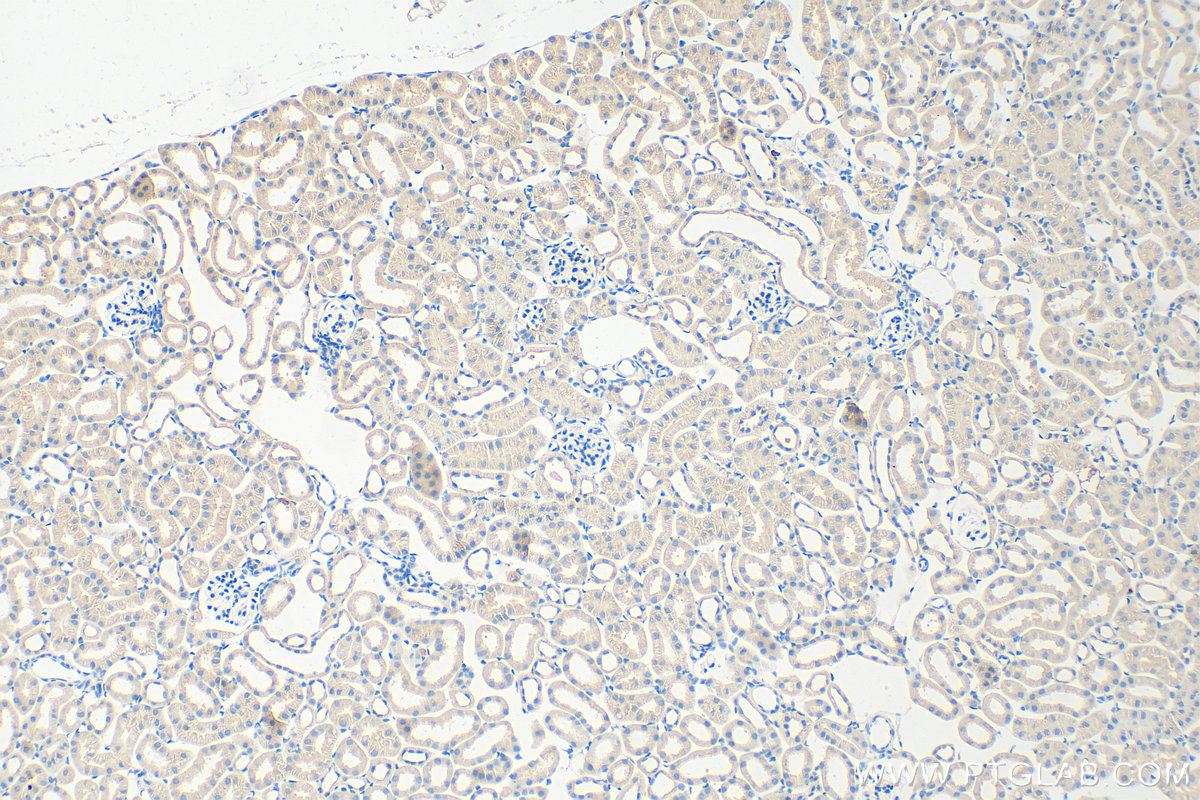 IHC staining of mouse kidney using 10642-1-AP