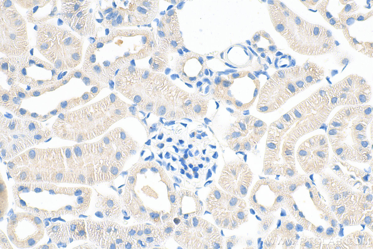 IHC staining of mouse kidney using 10642-1-AP